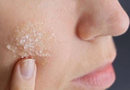 Esfoliazione pelle Esfoliazione pelle