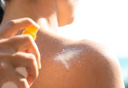 Arrossamento della pelle come-prevenirlo