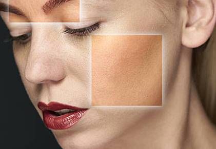 Pelle mista: le cause